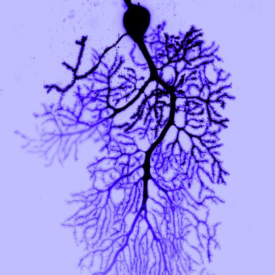 Purkinje Neuron with dendrites in blue can my brain get too full Image Credit: Dana Simmons, Christian Hansel Lab, The University of Chicago