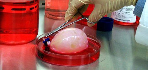 Artificial Organs? How We Can Get There with 3D Printing