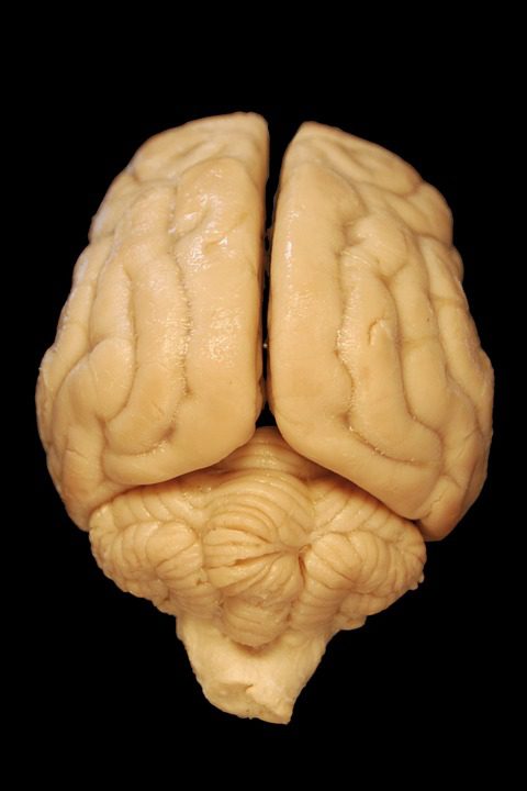 Compare the texture of this dog brain to the human brain in the photo at the beginning of this article. Which looks more wrinkly?