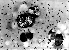 Black Plague (yersinia pestis) is a bacterium carried by infected fleas.