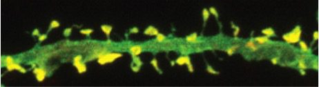 Dendrite in green, dendritic spines in yellow can my brain get too full